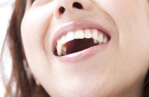 牙龈出血四诱因 3个方法可缓解_牙龈出血的原因？_怎样缓解牙龈出血-
